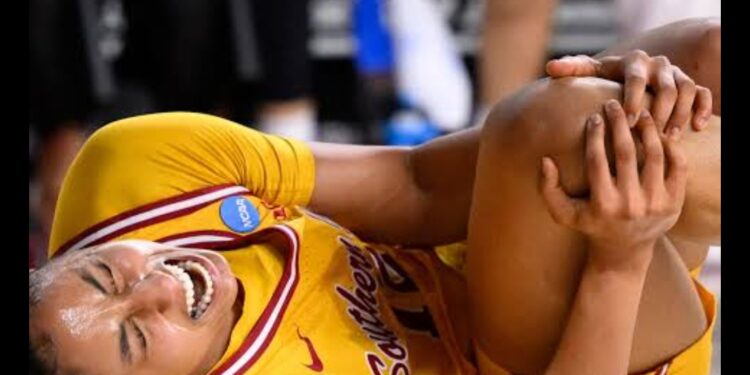 After Series of Different Tests and Results JuJu Watkins Will Go Under the Knife