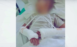 12-годишно момче с две счупени ръце е хвърлено от мост в Луковит, заподозрян е задържан за нападение.